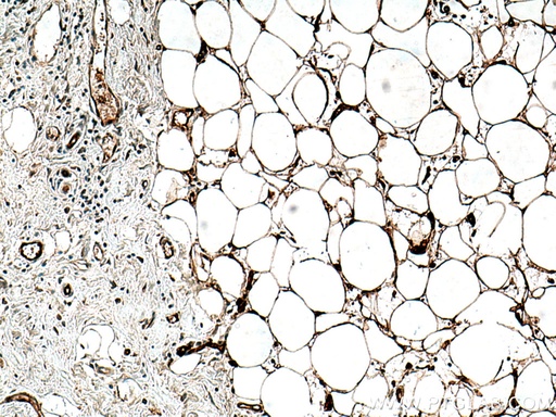 [67167-1-IG-150UL] FABP4 Monoclonal antibody