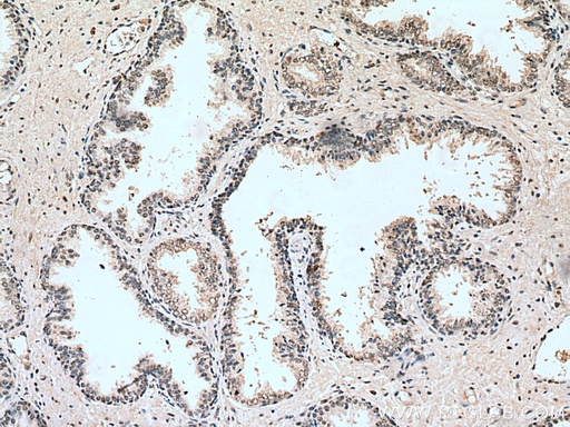 [67168-1-IG-20UL] HUS1 Monoclonal antibody