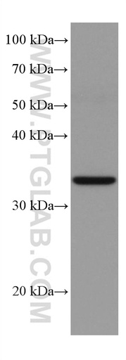 [67171-1-IG-20UL] TRIB2 Monoclonal antibody