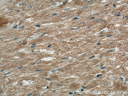 [67172-1-IG-150UL] FBXO32 Monoclonal antibody