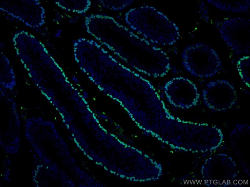 [67176-1-IG-150UL] DMC1 Monoclonal antibody