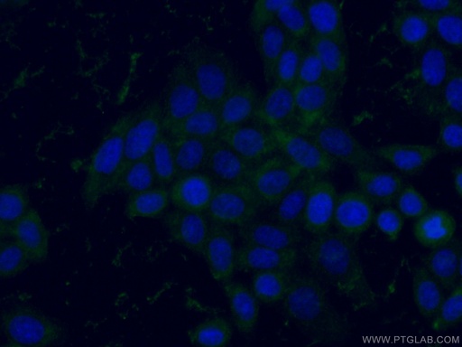 [67178-1-IG-150UL] GPI Monoclonal antibody