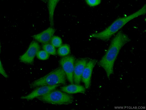 [67185-1-IG-150UL] Cytohesin 2 Monoclonal antibody