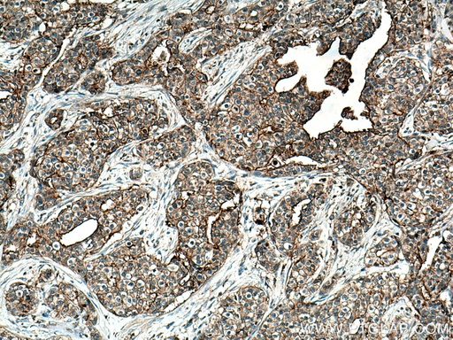 [67188-1-IG-20UL] GNA13 Monoclonal antibody