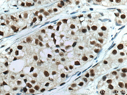 [67189-1-IG-150UL] HSF1 Monoclonal antibody