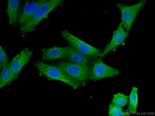 [67192-1-IG-20UL] VDR Monoclonal antibody