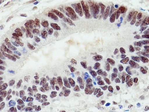 [67198-1-IG-20UL] UBE1 Monoclonal antibody