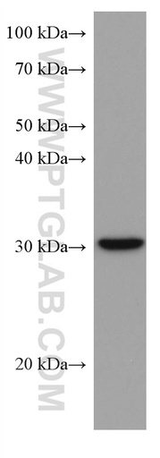 [67201-1-IG-150UL] PITX2 Monoclonal antibody