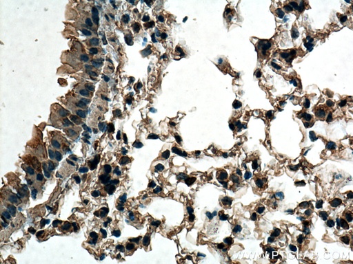 [67205-1-IG-150UL] TMEM111 Monoclonal antibody