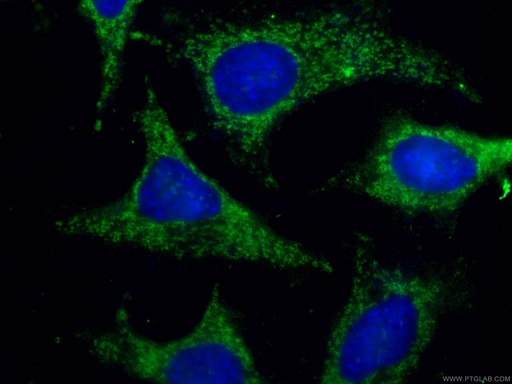 [67210-1-IG-150UL] WNT10B Monoclonal antibody