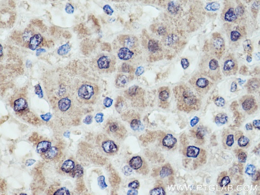 [67216-1-IG-150UL] GCK Monoclonal antibody