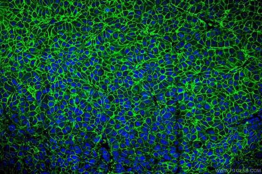 [67221-1-IG-20UL] SLC31A1 Monoclonal antibody