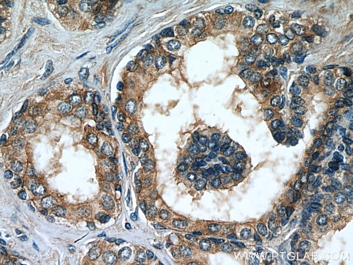 [67230-1-IG-150UL] MRP4 Monoclonal antibody