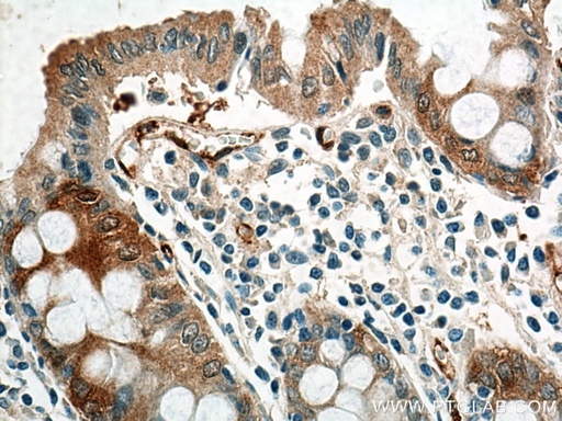 [67240-1-IG-150UL] NQO1 Monoclonal antibody