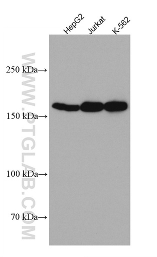 [67241-1-IG-20UL] Thrombospondin 1 Monoclonal antibody