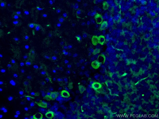 [67243-1-IG-150UL] MYH10 Monoclonal antibody