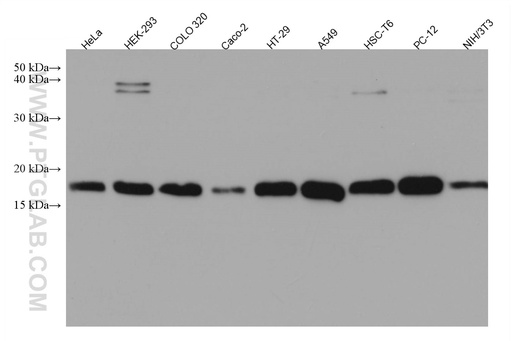 [67247-1-IG-150UL] TMEM230 Monoclonal antibody