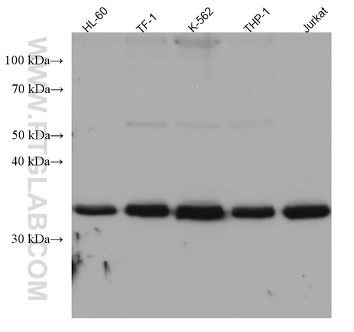 [67249-1-IG-150UL] ULBP2 Monoclonal antibody