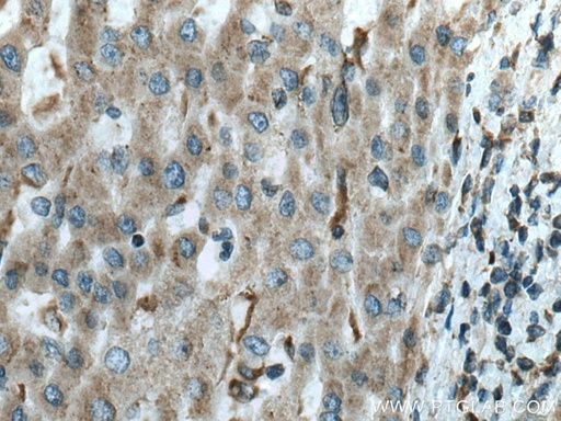 [67251-1-IG-150UL] FUCA1 Monoclonal antibody