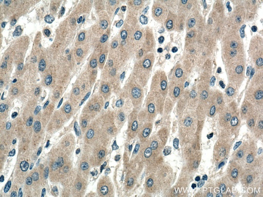 [67257-1-IG-150UL] SIRT5 Monoclonal antibody