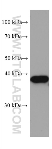[67262-1-IG-150UL] ZnT3 Monoclonal antibody