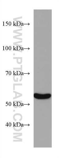 [67263-1-IG-20UL] CYP2E1-Specific Monoclonal antibody