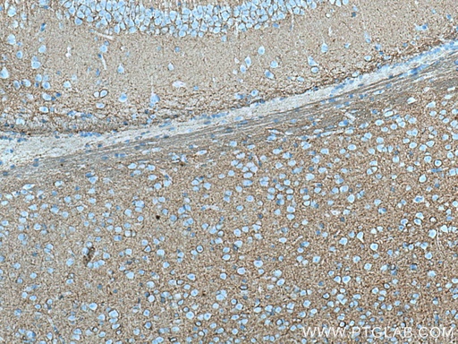 [67265-1-IG-20UL] PLXNB2 Monoclonal antibody