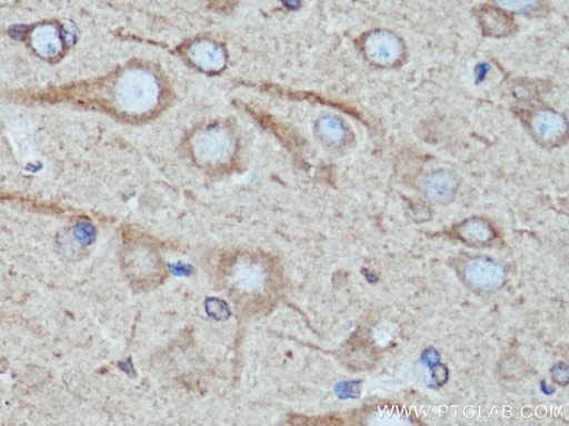 [67268-1-IG-20UL] TRIM9 Monoclonal antibody