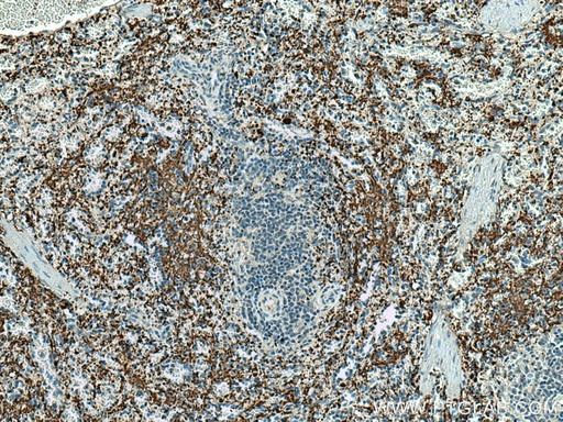 [67271-1-IG-150UL] GP9 Monoclonal antibody