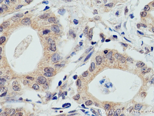 [67274-1-IG-150UL] WWP2 Monoclonal antibody