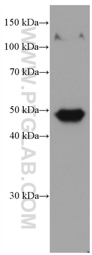 [67275-1-IG-20UL] Biglycan Monoclonal antibody