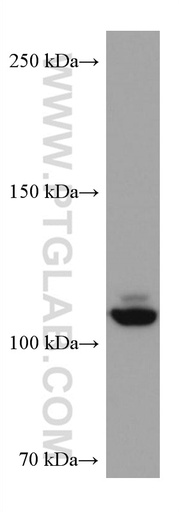 [67276-1-IG-20UL] NEDD4L Monoclonal antibody