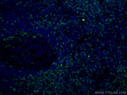 [67278-1-IG-20UL] CD5 Monoclonal antibody