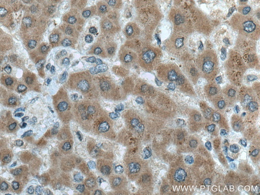 [67289-1-IG-150UL] ERN2 Monoclonal antibody
