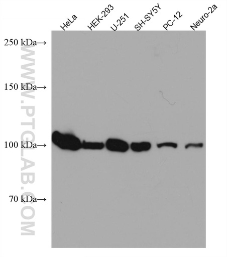 [67291-1-IG-20UL] WFS1 Monoclonal antibody