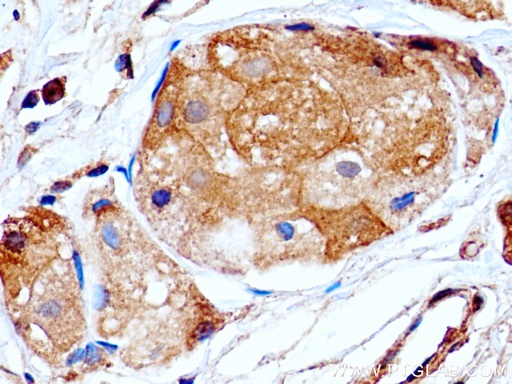 [67292-1-IG-20UL] PRLR Monoclonal antibody