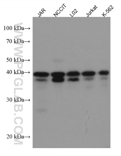 [67297-1-IG-150UL] KLF6 Monoclonal antibody