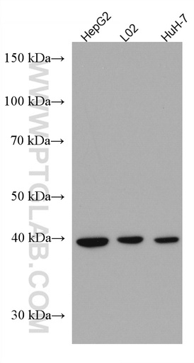 [67303-1-IG-20UL] ADH4 Monoclonal antibody