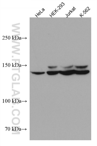 [67304-1-IG-20UL] FANCI Monoclonal antibody