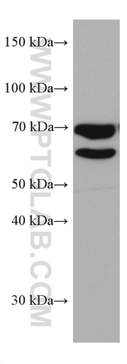[67312-1-IG-20UL] MTMR2 Monoclonal antibody
