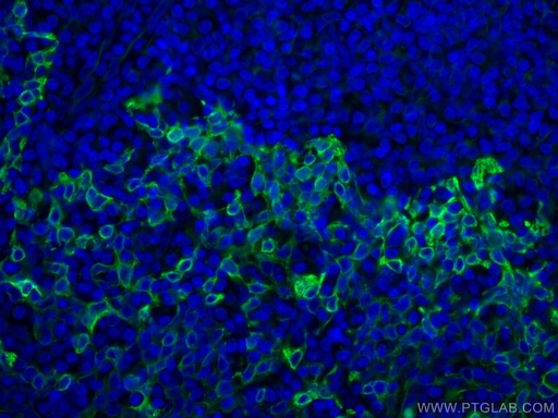 [67317-1-IG-20UL] TLR8 Monoclonal antibody
