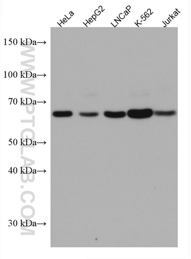 [67318-1-IG-150UL] UBP1 Monoclonal antibody
