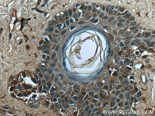 [67319-1-IG-150UL] TFE3 Monoclonal antibody