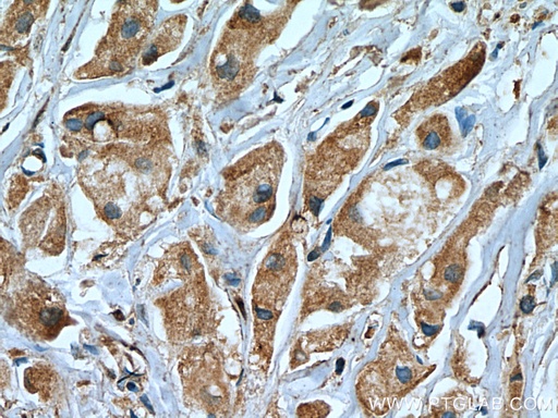[67321-1-IG-20UL] USP8 Monoclonal antibody