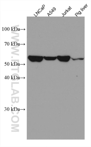 [67322-1-IG-20UL] EPHX2 Monoclonal antibody
