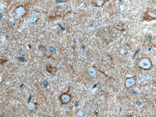 [67323-1-IG-20UL] Alpha SNAP Monoclonal antibody
