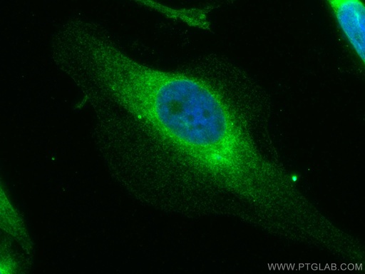 [67329-1-IG-150UL] GSK3B Monoclonal antibody