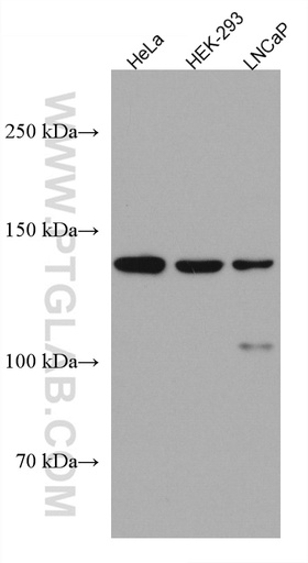 [67330-1-IG-20UL] WDR19 Monoclonal antibody