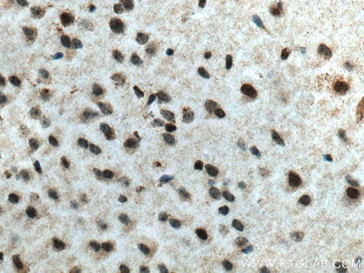 [67335-1-IG-150UL] RCC1 Monoclonal antibody