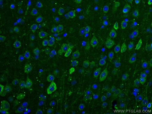 [67342-1-IG-20UL] TRIM2 Monoclonal antibody